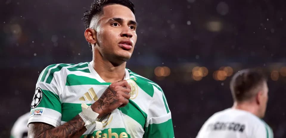 Jugador de Celtic durante el partido de Champions League