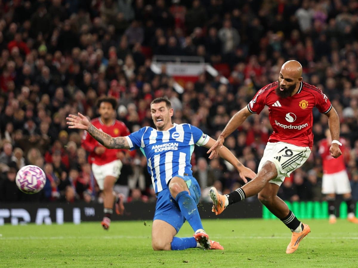 Jugador de Brighton cae mientras Manchester United ataca