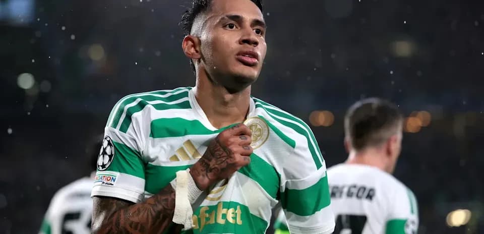 Jugador de Celtic mostrando su camiseta en el campo